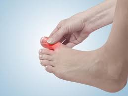 Daily Habits to Help You Manage the Discomfort of Bunions