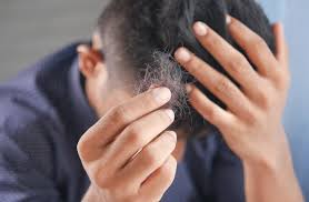 Hair Transplant: What To Expect During Your Hair Restoration Journey